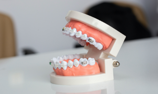 Orthodontist Specialist Clinic Canberra Capital Smiles - clear braces