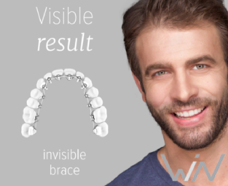 Orthodontics Australia  Your Guide to Lingual Braces [Including